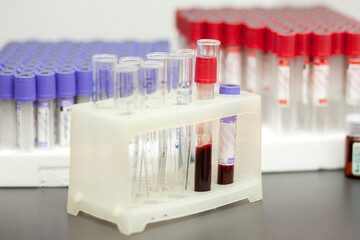 medical test tubes stand on the table with blood tests