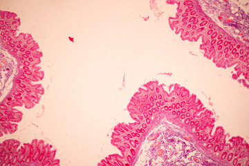 Tissue of Small intestine (Duodenum), Large intestine Human and Stomach Human under the microscope...