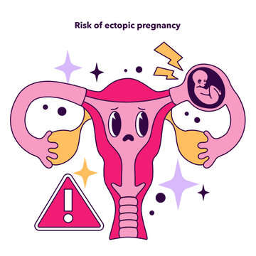 Risk of ectopic pregnancy as a disadvantage of In vitro fertilization.