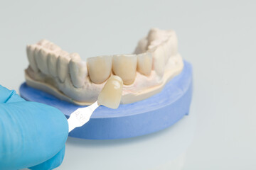 Dental imprint with artificial dentition and tools in a dental laboratory to check veneer of teeth