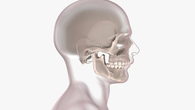 3d animation of orthognathic surgery
