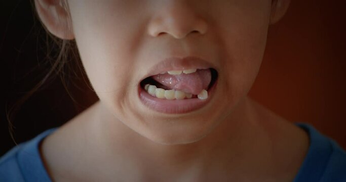Close up on asian child girl open mouth showing rocking milk teeth