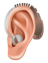 Hearing aid. Sound amplifier for patients with hearing loss. Medicine and health. Realistic object behind the ear. Treatment and prosthetics in otolaryngology