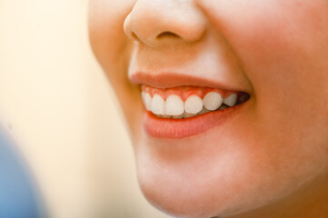 Fototapeta premium Close up smiling in dental clinic.Dentist examining teeth patients in clinic for better dental health and a bright smile.Hygienist concept of a healthy and beautiful smile.