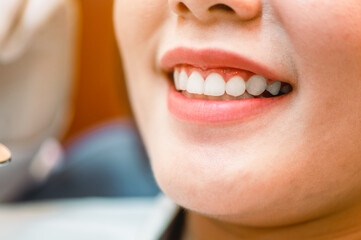 close up smiling in dental clinic.Dentist examining teeth patients in clinic for better dental health and a bright smile.Dentist tools and equipment.