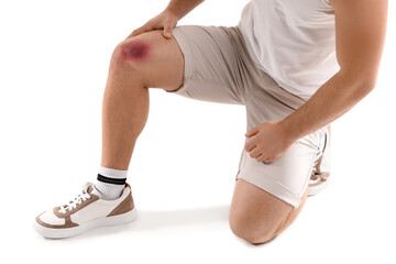 Man with bruise on knee against white background