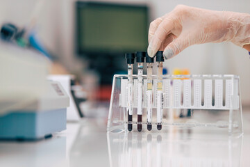 Exames Laboratoriais, Saúde!