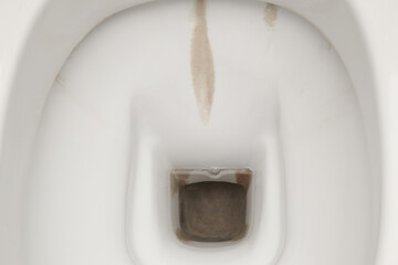 Dirty toilet bowl with limescale stain deposits. A toilet with traces of limescale, salt and stone...