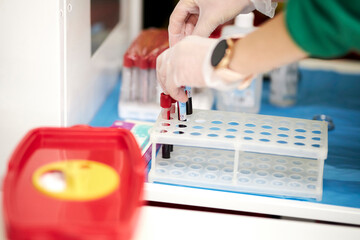 Plastic test tubes with blood samples stand on a stand in a hospital. A medical container with a blood sample standing on the table in the laboratory of hospital. Medical equipment in the laboratory.