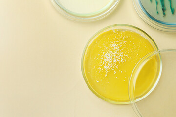 Petri dishes with different bacteria colonies on beige background, flat lay. Space for text