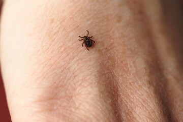 mite,Ixodid, encephalitic live tick on the human body close-up, macro photography.