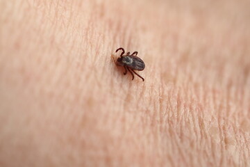 mite,Ixodid, encephalitic live tick on the human body close-up, macro photography.