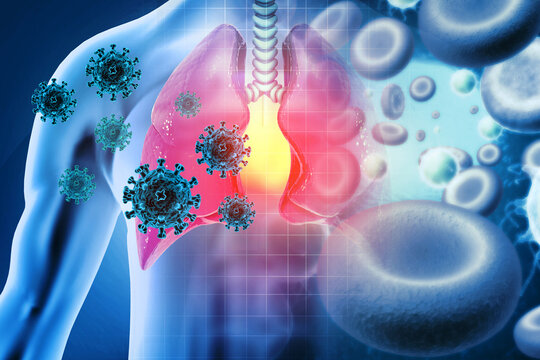 Virus attacking the human lungs. Lung disease. Viral infection. 3d illustration