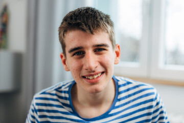 Portrait of a happy young adolescent boy with pimples