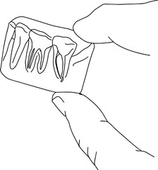 Outline sketch of hand holding small x-ray of teeth