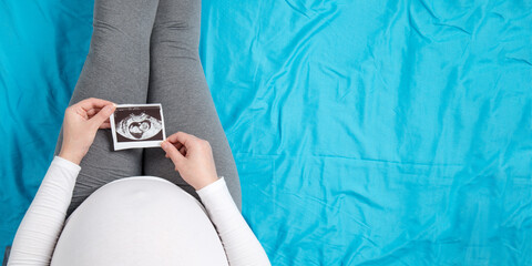 A pregnant girl holds an ultrasound shot. Waiting for the birth of a child. Copy space.
