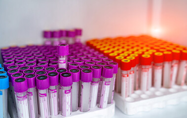 Plastic tubes for blood diagnostic. Biochemistry laboratory researchment.