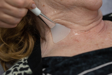 Elderly woman receiving radiofrequency lifting procedure for face skin rejuvenation and anti-age at aesthetic cosmetology center. RF lifting in beauty clinic.
