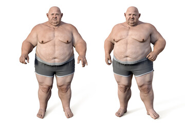 Obese man, 3D illustration. Concept of obesity