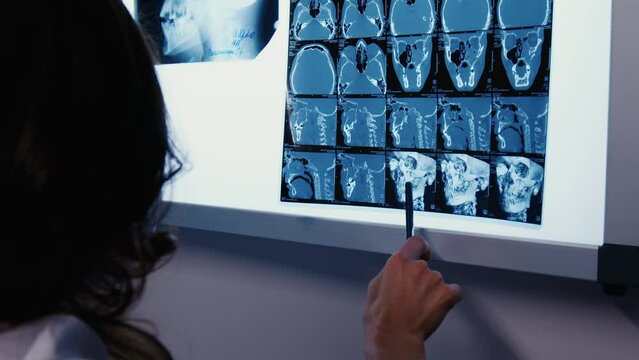 The doctor examining the magnetic resonance image of the head. X-ray of a head