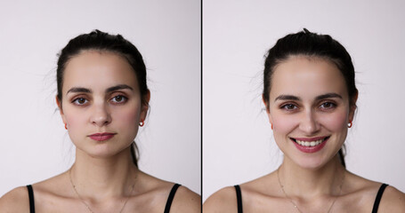 Before After Young Woman Aesthetic Facelift.