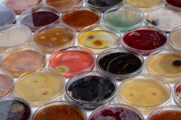 photo of collection of plastic plates containing culture media with growth of microorganisms
