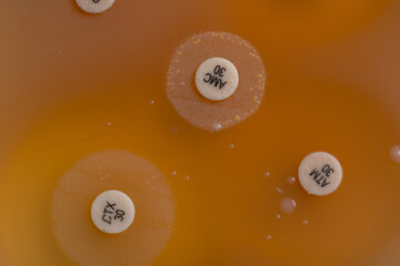 plates containing culture media with growth of microorganisms