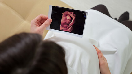 Pregnant woman strokes own belly at home and looks at ultrasound photo of future baby. Gravid lady...