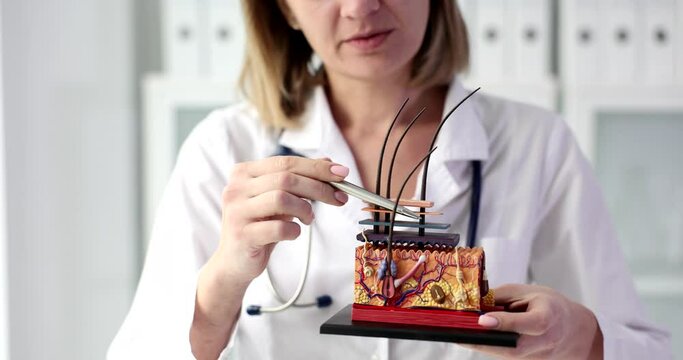 Female doctor holds plastic model of skin structure