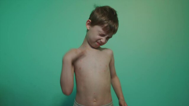 small kid has chickenpox with red rash spots and itch body torso