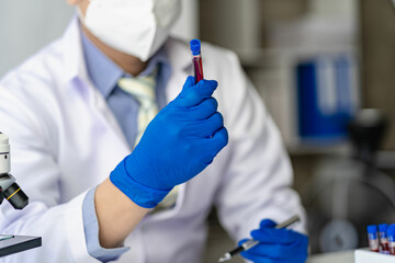 Doctor's hands in medical gloves holding a test tube with red blood for the sagittal microscopic test in the hematology laboratory at the hospital