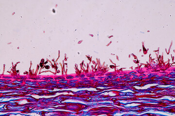 Host cells with spores (mold) are inside wood under the microscope for education.	