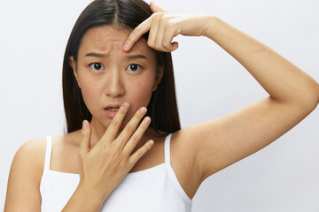 Asian woman facial skin problems, acne and inflammation, red rashes and allergies, chicken pox,...