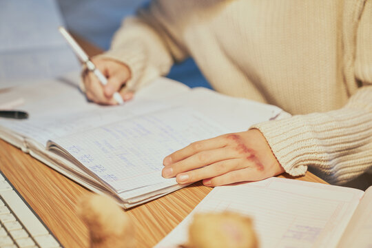 The concept of domestic abuse of a child. Cropped shot of a little girl with bruises on her arms doing her homework at desk. A girl sitting at the table and writing in her notebook.