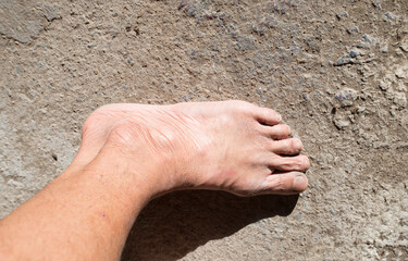 Elderly bare feet with wrinkled, rough skin.