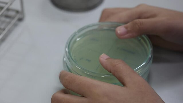 Cultivation of microorganisms on agar medium plate in microbiology laboratory and aseptic technique.