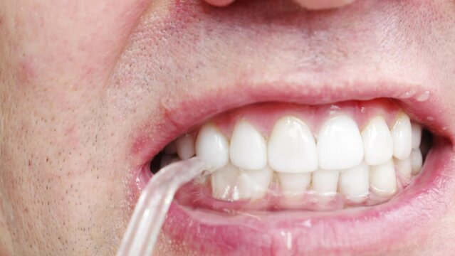 a man's mouth close-up. a man brush your teeth with Oral Irrigator. concept of hygiene and health of teeth and oral cavity. daily care and brushing of teeth. 