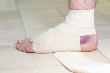 Young man with sprained ankle on grey background. - obrazy, fototapety, plakaty