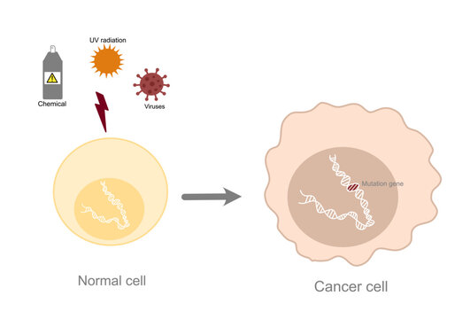 The picture shows risk factor (UV radiation, Chemical and microorganism) of gene mutation or changing were inducing in normal cells to cancer cell.