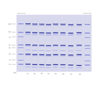 The SDS-PAGE (sodium dodecyl sulfate-polyacrylamide gel electrophoresis) result of target protein detection that molecule separating with molecular mass