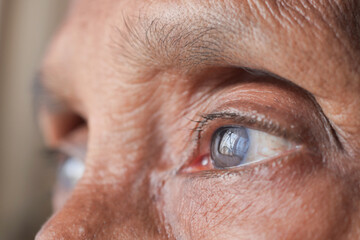 detail shot of asian senior women eye 