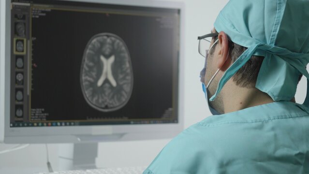 Medic doctor looking at patient brain magnetic resonance image before surgery