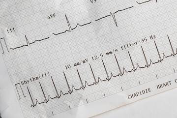 Cardiogram, waves of heart beat, EKG on the paper