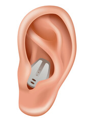 Hearing aid. Sound amplifier for patients with hearing loss. Medicine and health. Realistic object behind the ear. Treatment and prosthetics in otolaryngology