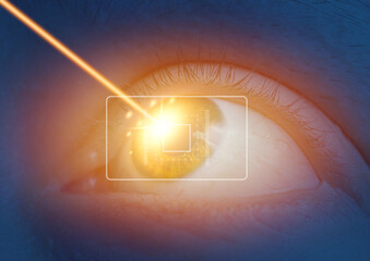 close up of female eye with laser beam hitting the iris