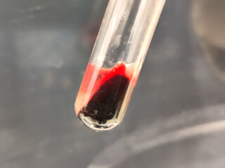 Blood sample for SARS-COV-2, COVID-19 Omicron XBB.1.5 variant test. The new sub variant of...