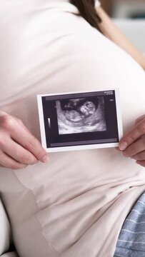 Pregnant Woman With Ultrasound Image