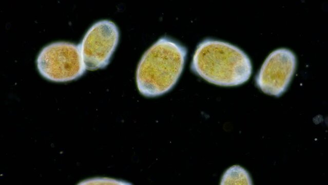 Trochophore larvae under a microscope, possibly at stage of parenchymella from phylum Porifera. Sample was collected in the middle of June in White Sea.