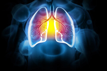 Chronic obstructive pulmonary disease, respiratory diseases, 3d illustration. - obrazy, fototapety, plakaty