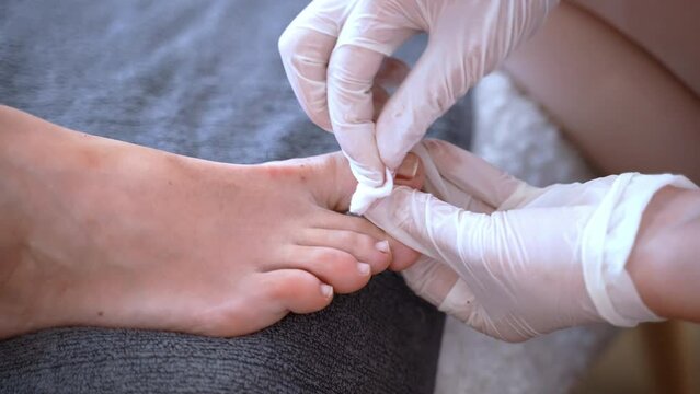 Professional beautician in disposable gloves removing old nail polish from client's toe nails with acetone solution and cotton pad, pedicurist preparing woman feet for soaking in warm water and